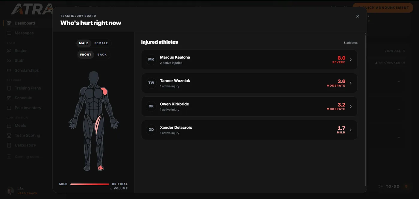 The team injury board on the Atra dashboard: a body map with the injured areas shaded, and four injured athletes listed with their pain score, from severe to mild.